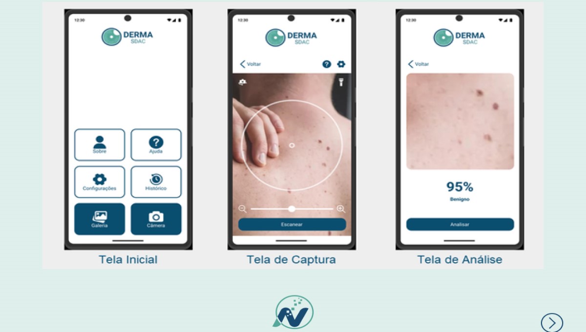 Laboratório de Análise de Imagens e Sinais do Nutes desenvolve aplicativo que ajuda a rastrear câncer de pele