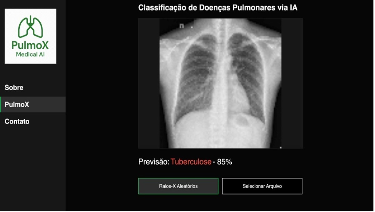 Coordenadoria de Inovação Tecnológica faz depósito de software para classificação de doenças pulmonares
